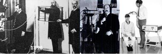Ιστορία TMS